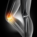 pain-in-the-knee-joint_1048-2351